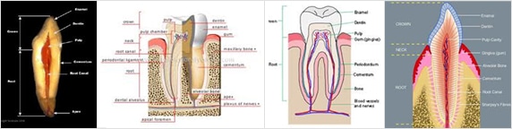 img_rootcanal01